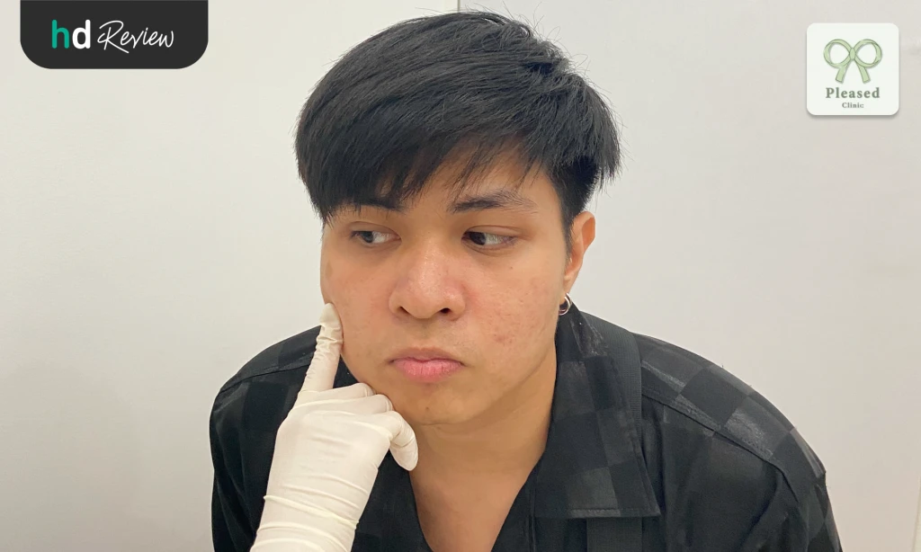 เปลี่ยนหน้าหลุม เป็นหน้าใส! รีวิวประสบการณ์รักษาหลุมสิวด้วยโปรแกรม Derma Pen ที่ Pleased Clinic 8 เปลี่ยนหน้าหลุม เป็นหน้าใส! รีวิวประสบการณ์รักษาหลุมสิวด้วยโปรแกรม Derma Pen ที่ Pleased Clinic