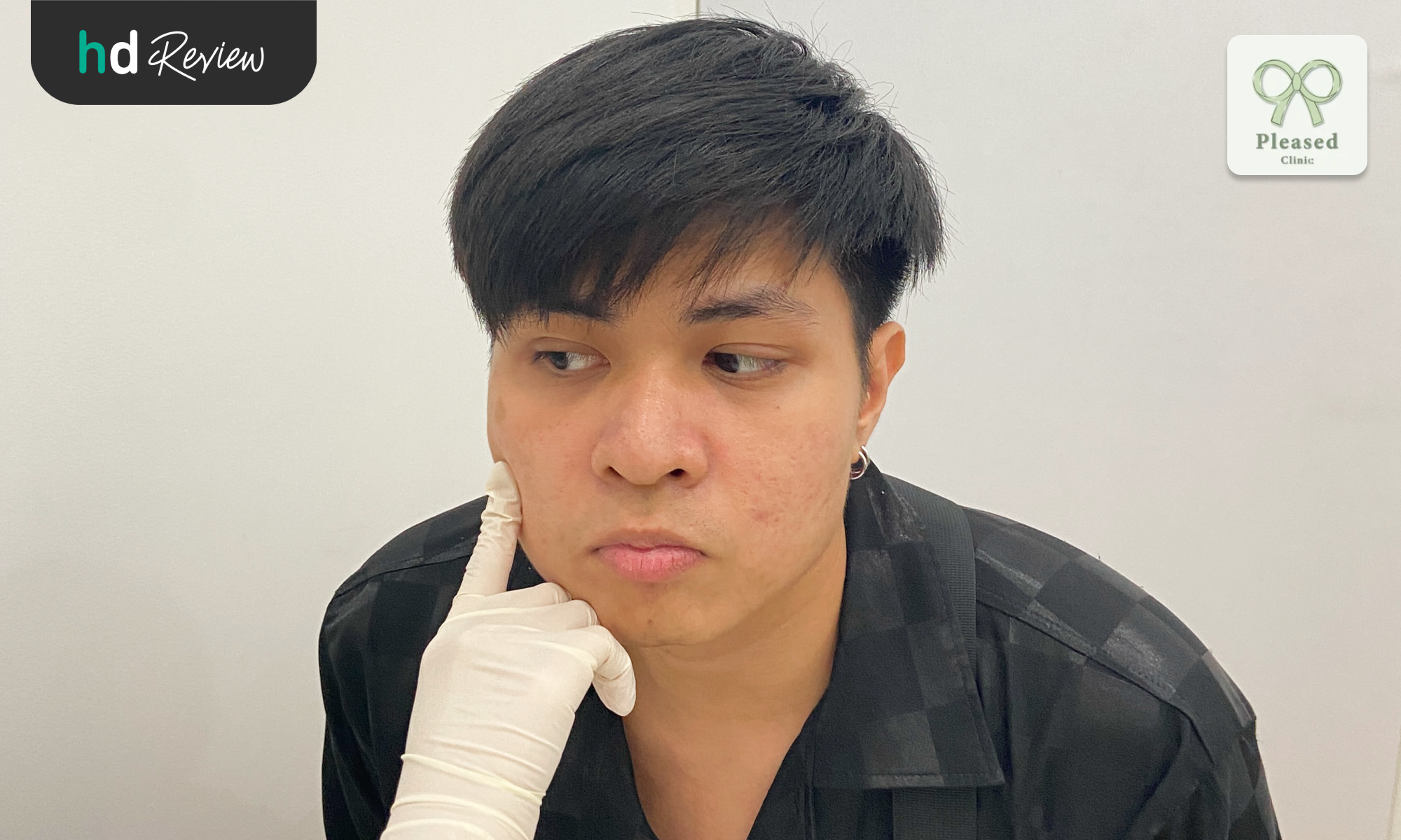 derma pen at pleased clinic by dream tharatorn12