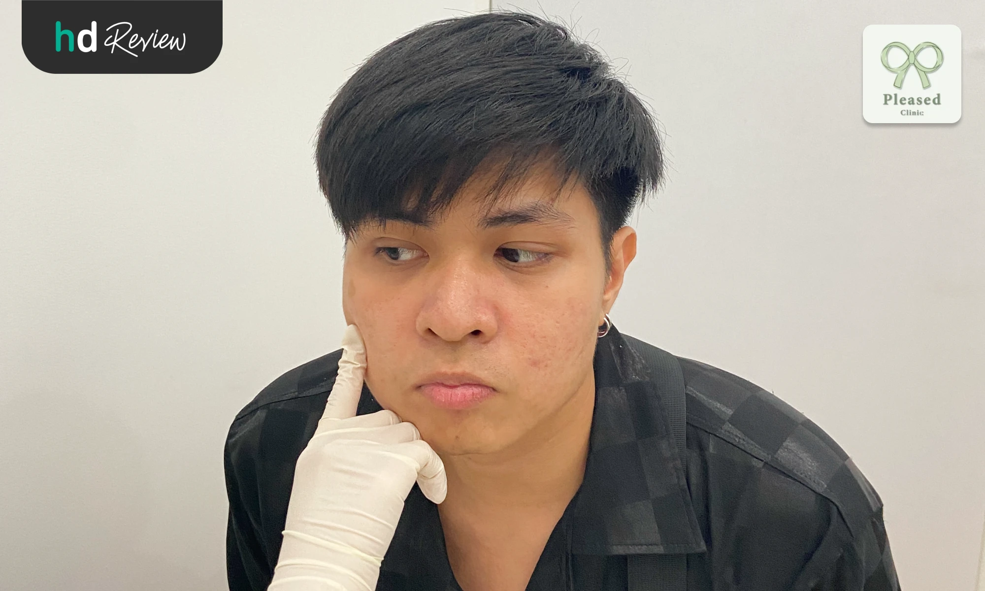 derma pen at pleased clinic by dream tharatorn12