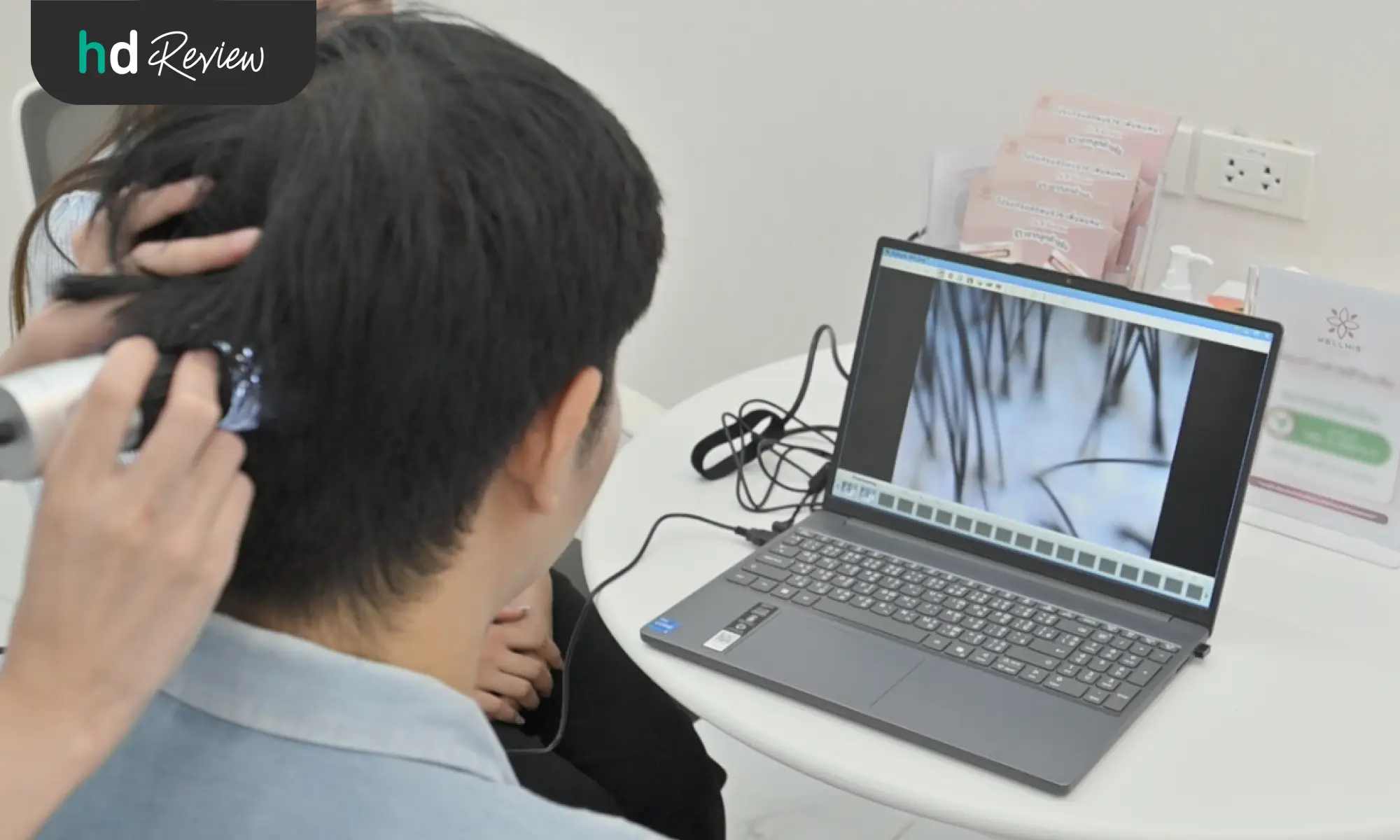 รีวิวรักษาผมร่วง ผมบาง ภายใน 4 ขั้นตอน กับ Hair Regrowth Program ที่ Wellnis Clinic 5 รักษาผมร่วง