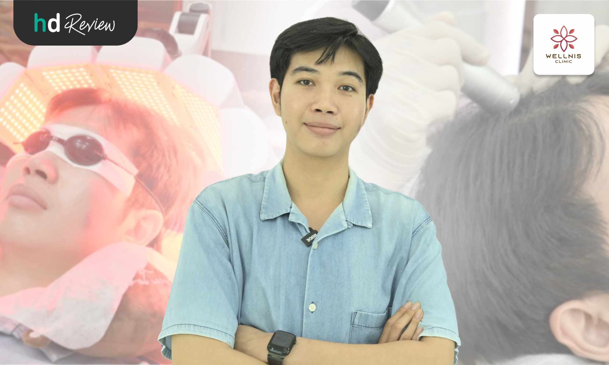 hair regrowth program at wellnis clinic by petch kompech3