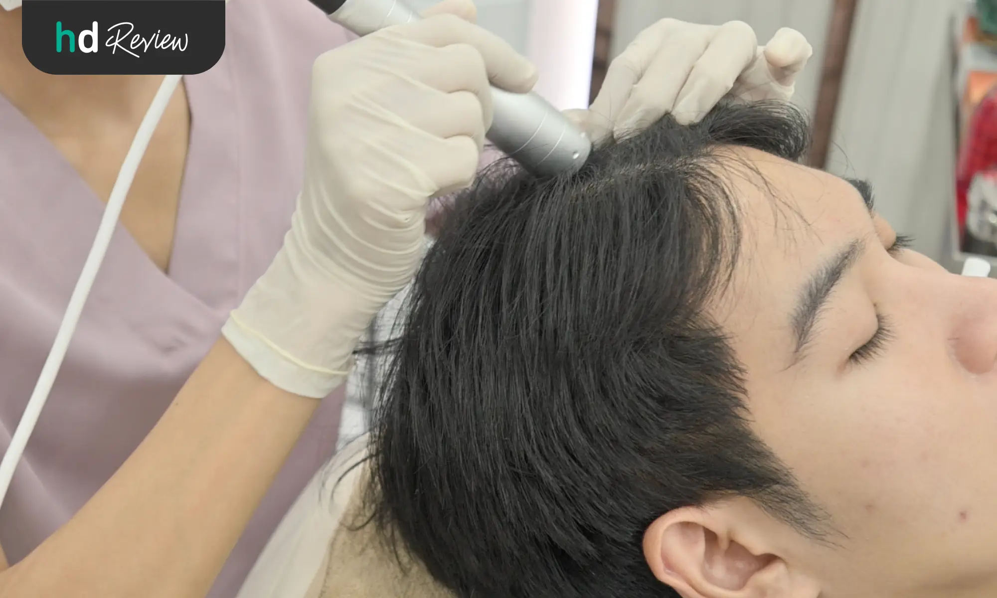 รีวิวรักษาผมร่วง ผมบาง ภายใน 4 ขั้นตอน กับ Hair Regrowth Program ที่ Wellnis Clinic 8 รักษาผมบาง