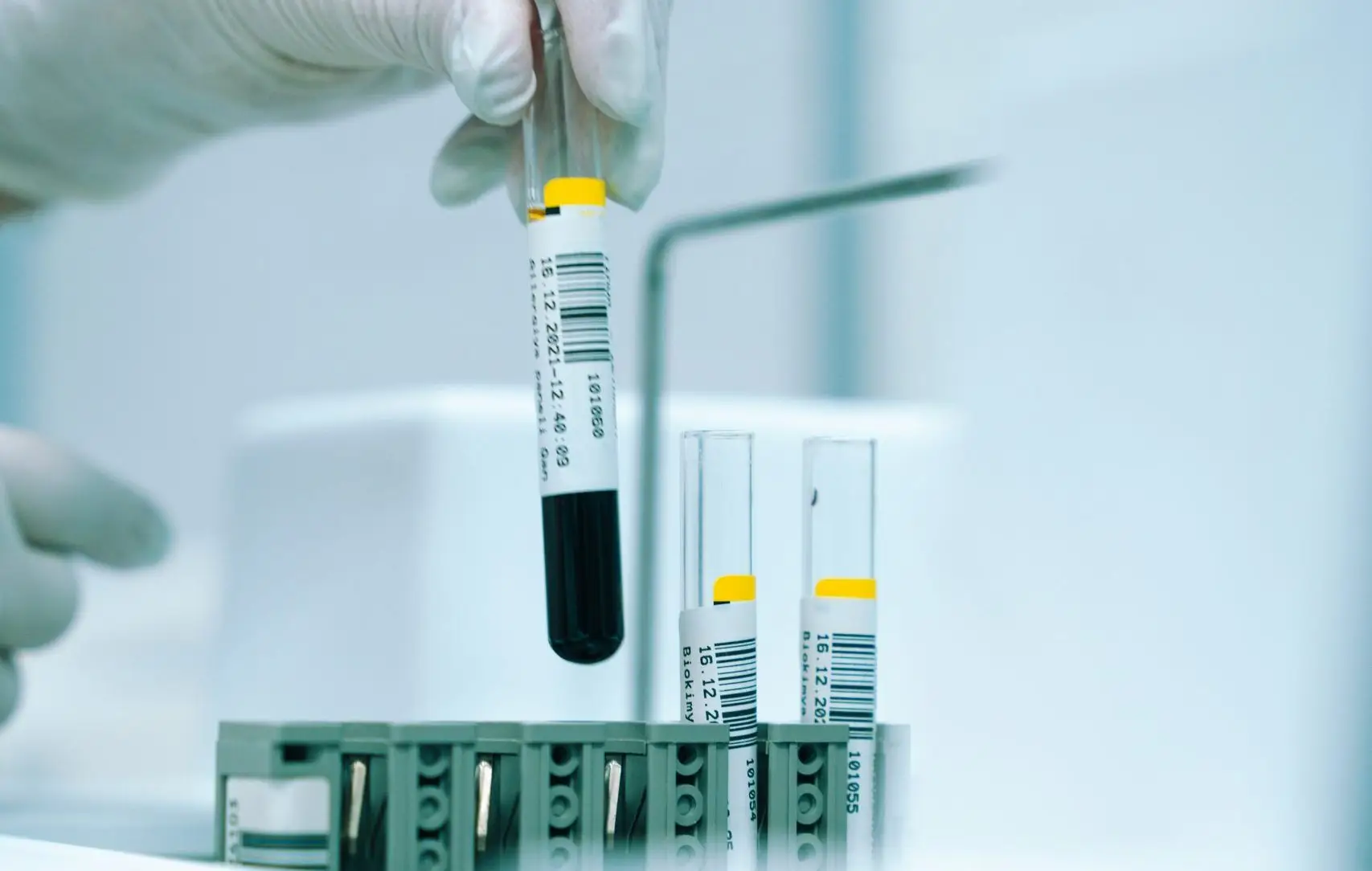 สิวเรื้อรัง ท้องอืด ปวดหัวบ่อย สัญญาณ akram huseyn fKC9eWRnlGY unsplash scaled e1769669727659