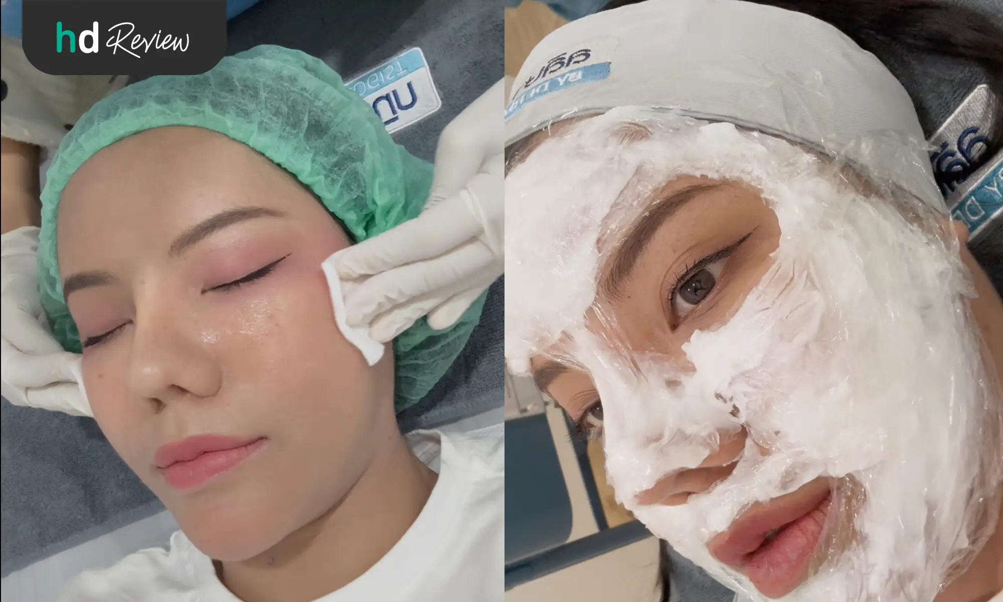 รีวิวโปรแกรม Discovery Pico Laser แก้ปัญหาผิวหน้าไม่เรียบเนียน ที่ Laliza Clinic 6 Discovery Pico Laser เจ็บไหม
