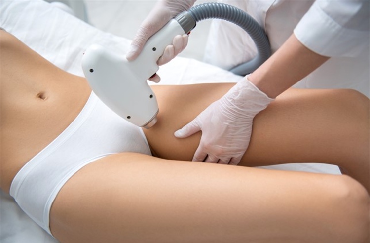 เลเซอร์กำจัดขนขอบบิกินี่ ด้วยเครื่อง GentleYAG Pro-U 1 ครั้ง ที่ The Sign Clinic