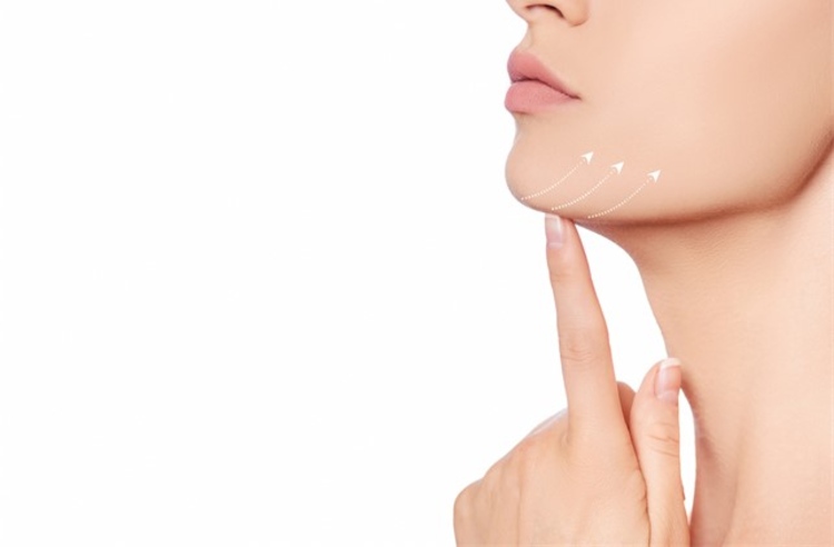 ฉีดฟิลเลอร์สวีเดน Restylane บริเวณคาง 1 ซีซี 1 ครั้ง ที่ Millennium Anti Aging Clinic