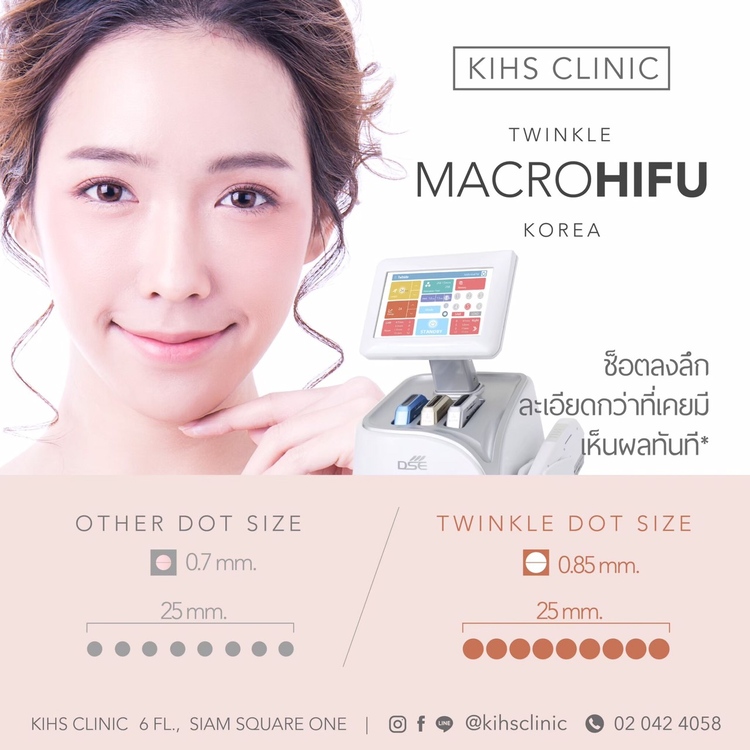 ทำ Macro HIFU ไม่จำกัดช็อต ทั่วใบหน้า รวมเหนียง 1 ครั้ง ที่ KIHS Clinic