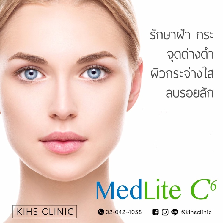 เลเซอร์หน้า ด้วยเทคโนโลยี MedLite C6 1 ครั้ง ที่ KIHS Clinic