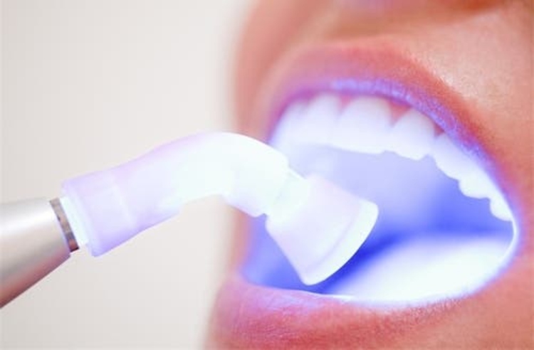ฟอกสีฟันที่คลินิก ด้วยระบบ Cool light พร้อมขูดหินปูน ที่ Bangkok Dental Care