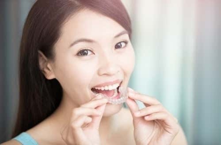 คอร์สจัดฟันแบบใส Invisalign Go ฟันบนและล่าง ที่ Asoke Montri Dental Clinic (อโศกมนตรีเด็นทัลคลินิก)