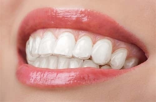คอร์สจัดฟันแบบใส Clear Aligner 2 เซ็ต บนและล่าง (แล็บไทย) ที่ Deezy Dental Home