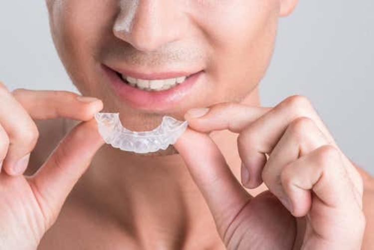 คอร์สจัดฟันแบบใส Invisalign Lite ฟันบนและล่าง ที่ Smile Society Dental (คลินิกทันตกรรมสไมล์โซไซตี้)