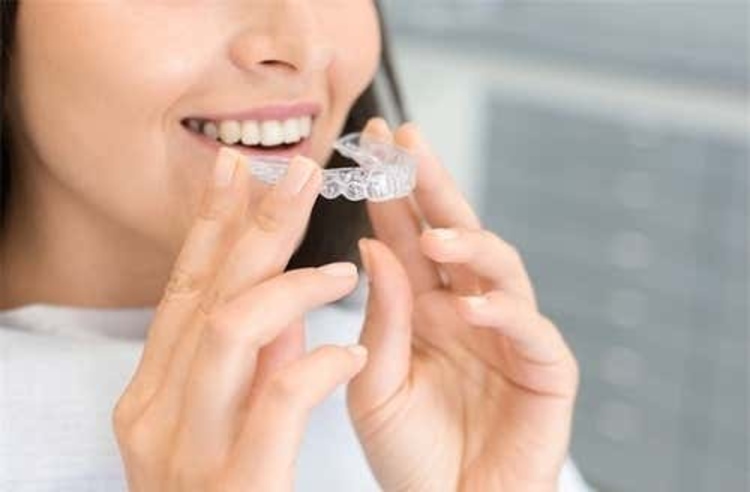 คอร์สจัดฟันแบบใส Invisalign Lite ฟันบนและล่าง ที่ Tooth Box Dental Clinic (คลินิกทันตกรรมทูธบอกซ์)