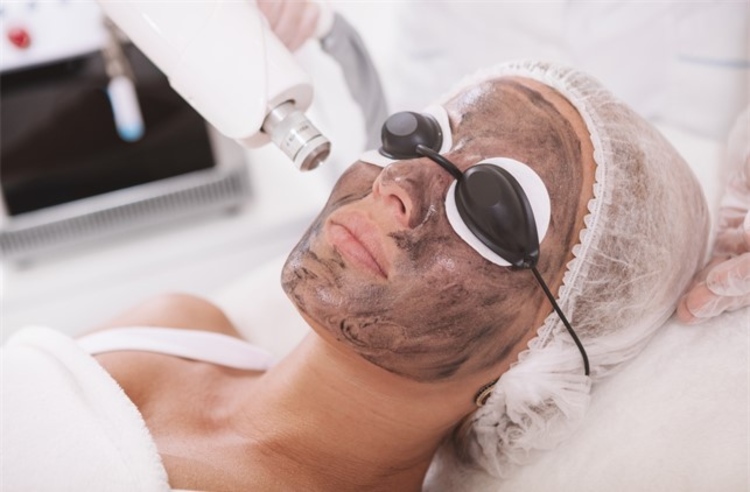 ทำเลเซอร์ Carbon Peel บริเวณใบหน้า แก้ปัญหาริ้วรอย รูขุมขน สิว 1 ครั้ง ที่ Divine Aesthetic Clinic