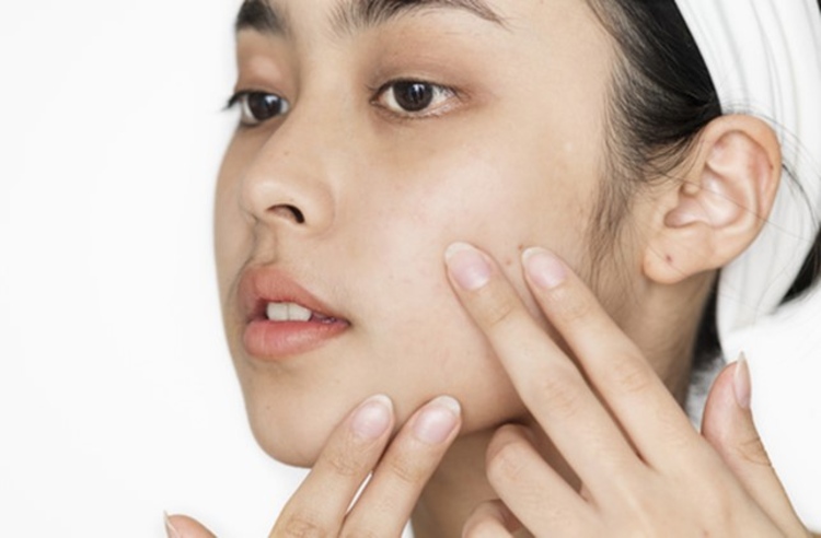 ฉีดฟิลเลอร์สวีเดน Restylane บริเวณร่องแก้ม 1 ซีซี 1 ครั้ง ที่ Millennium Anti Aging Clinic