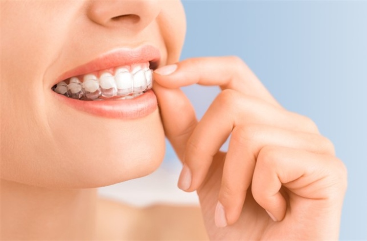 คอร์สจัดฟันแบบใส Invisalign i7 ฟันบนและล่าง ที่ Orthosmile Dental Clinic