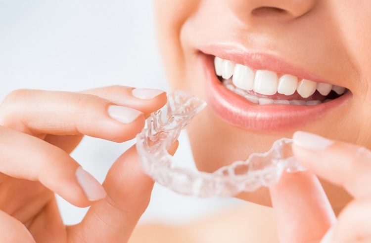 คอร์สจัดฟันแบบใส Invisalign Lite ฟันบนและล่าง ที่ Orthosmile Dental Clinic