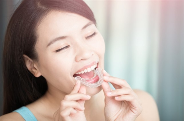 คอร์สจัดฟันแบบใส Invisalign i7 ฟันบนและล่าง ที่ Dental Design Center