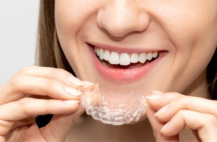 คอร์สจัดฟันแบบใส Invisalign Full Comprehensive ฟันบนและล่าง ที่ Dental Design Center