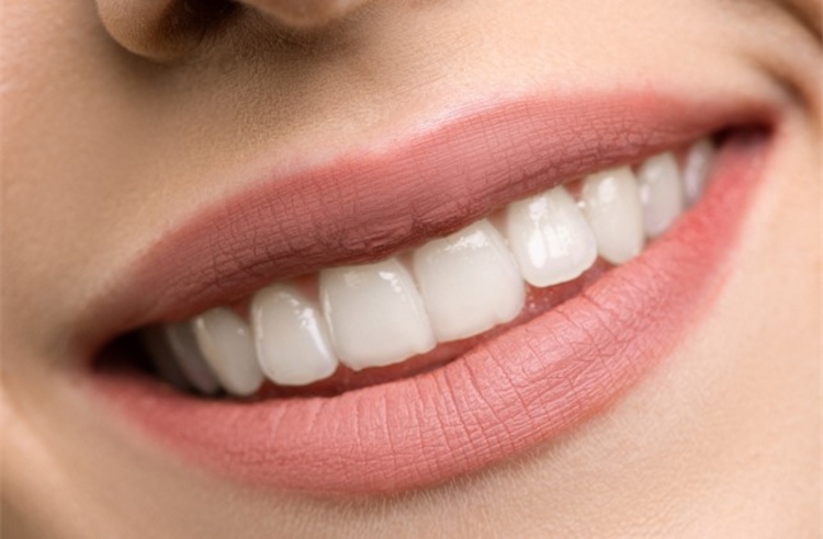 ฟอกสีฟัน ด้วยระบบ Cool Light ที่ Be Bright Dental Clinic
