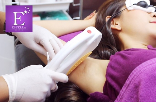 คอร์สกำจัดขนรักแร้ ด้วย IPL เครื่อง Medisyst Laser Advance IPL Gen 2 12 ครั้ง ภายใน 1 ปี สำหรับผู้หญิงเท่านั้น ที่ Estella Clinic