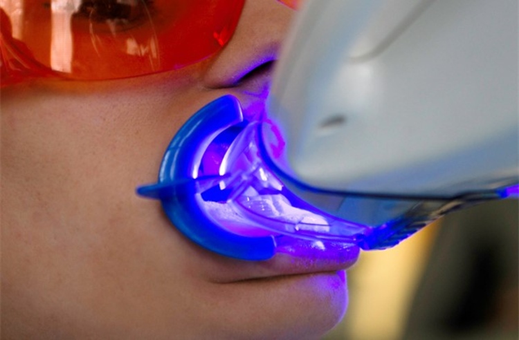 ฟอกสีฟัน ด้วยระบบ Cool Light ที่ Hollywood Smile Dental Center พัทยา