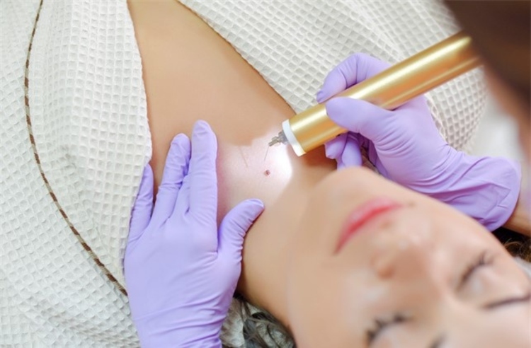 ฉีดรักษาแผลเป็นคีลอยด์ 1 ครั้ง ที่ GROW & GLOW Clinic