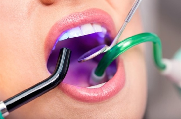 ฟอกสีฟัน ด้วยระบบ Cool Light พร้อมขูดหินปูน และเคลือบฟลูออไรด์ ที่ Double B Dental Clinic