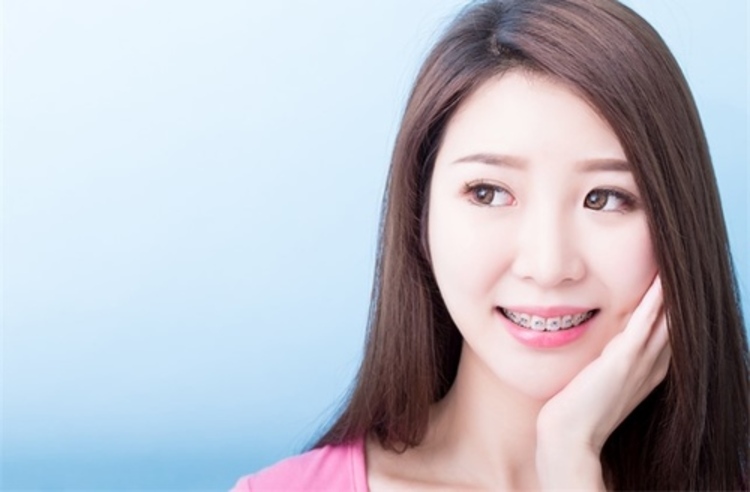 คอร์สจัดฟันแบบโลหะ สำหรับเคสระยะสั้น (12 เดือน) ฟันบนและล่าง ที่ Teeth Solution Clinic