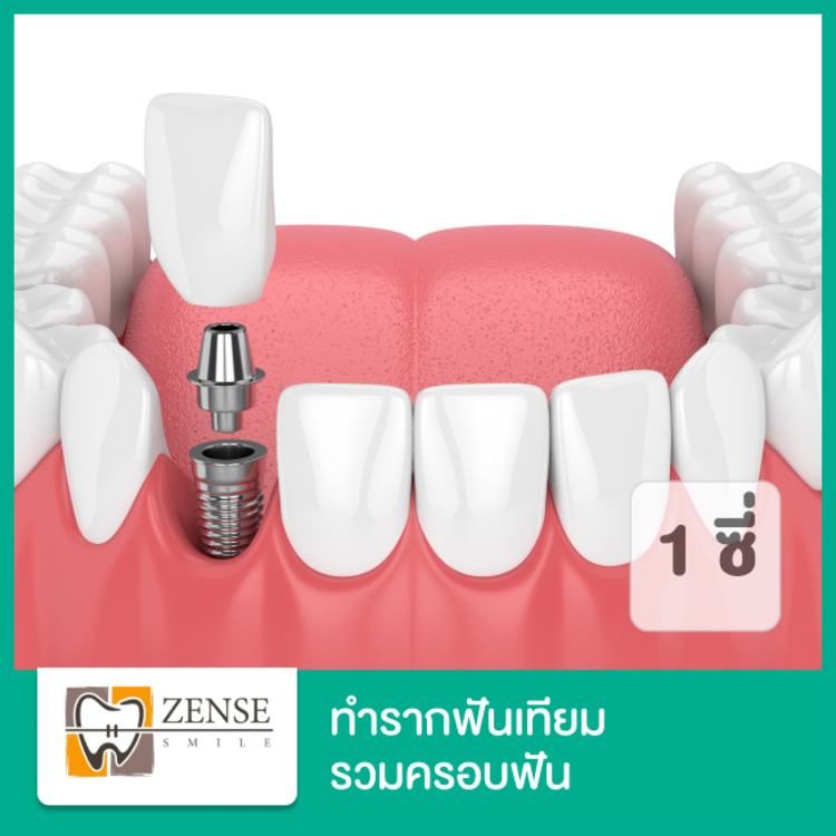 ทำรากฟันเทียม ยี่ห้อ Dentium รวมครอบฟัน 1 ซี่ ที่ Zense Smile