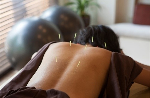 ฝังเข็มรักษาอาการนอนไม่หลับ 1 ครั้ง (TCM Treatment) ที่ ดวงกมลคลินิกกายภาพบำบัด และการแพทย์แผนจีน