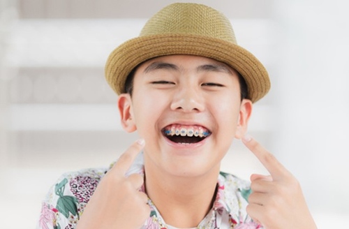 จัดฟันแบบโลหะ ที่ 3D Dental Clinic
