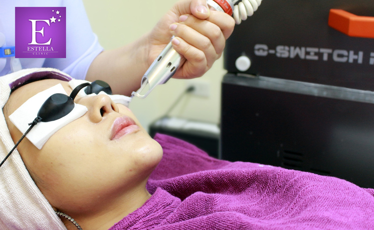 เลเซอร์ Q-Switch ปรับสภาพผิวหน้า 1 ครั้ง ที่ Estella Clinic