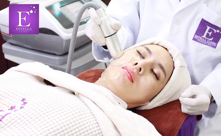 ทำ HIFU ด้วยเครื่อง V-Max HIFU 1,200 ช็อต บริเวณใบหน้า 1 ครั้ง ที่ Estella Clinic
