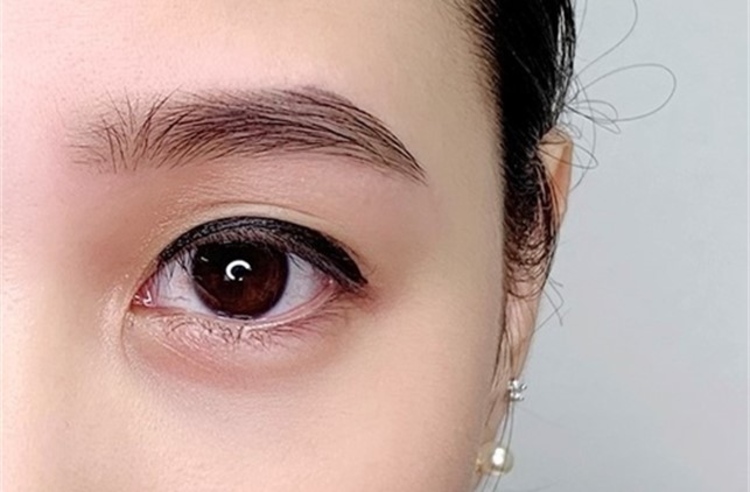 ฉีดวิตามินบำรุงใต้ตา (Blink Eye Advance) 1 ครั้ง ที่ The Cocktail Clinic