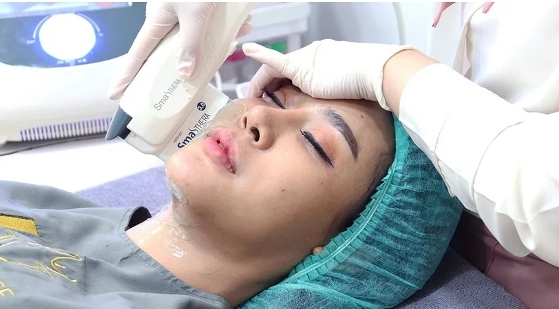 ทำ HIFU Smashthera 3 in 1 ไม่จำกัดช็อต บริเวณใบหน้ารวมเหนียง 1 ครั้ง ที่ Levince clinic