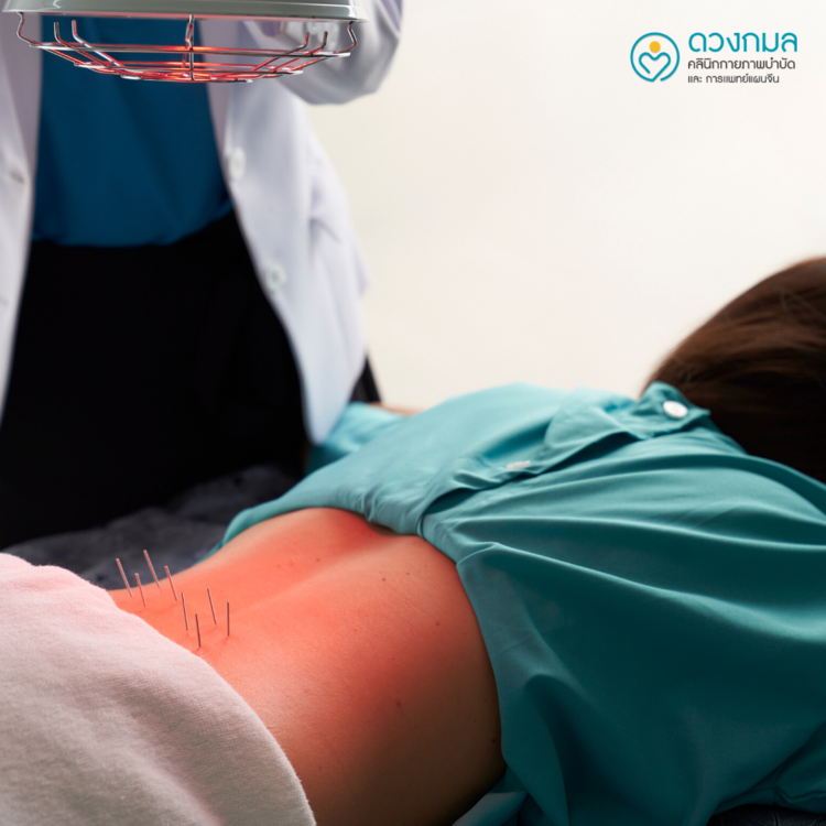 ฝังเข็มบรรเทาอาการภูมิแพ้ 1 ครั้ง (TCM Treatment) ที่ ดวงกมลคลินิกกายภาพบำบัด และการแพทย์แผนจีน