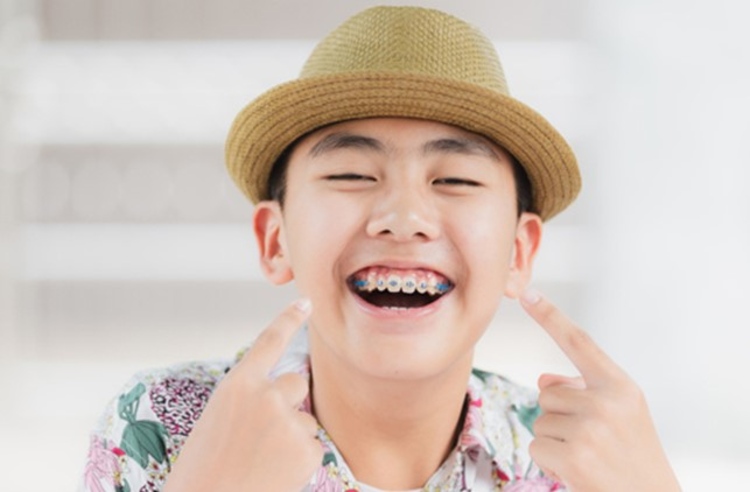 จัดฟันแบบโลหะ ที่ 3D Dental Clinic