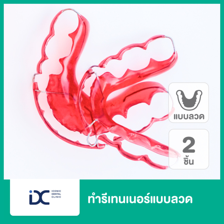 ทำรีเทนเนอร์แบบลวด 2 ชิ้น ฟันบนและล่าง ที่ Iconic Dental Clinic