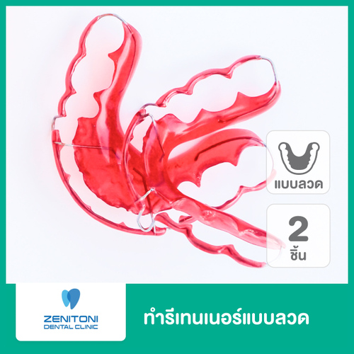 ทำรีเทนเนอร์แบบลวด 2 ชิ้น ฟันบนและล่าง ที่ Zenitoni Dental Clinic