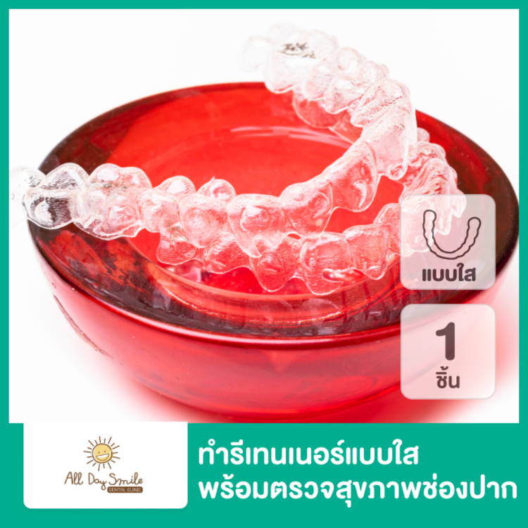 ทำรีเทนเนอร์แบบใส 1 ชิ้น (บนหรือล่าง) พร้อมตรวจสุขภาพช่องปาก ที่ All Day Smile Dental Clinic (คลินิกทันตกรรมออลเดย์สไมล์)