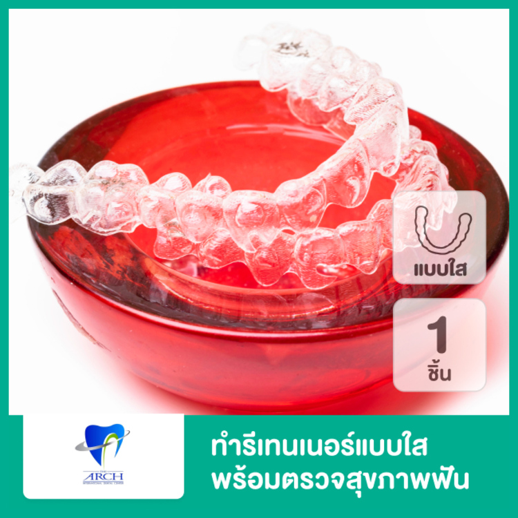 ทำรีเทนเนอร์แบบใส 1 ชิ้น (บนหรือล่าง) พร้อมตรวจสุขภาพฟัน ที่ The ARCH Dental Center (ศูนย์ทันตกรรมดิอาร์ช)