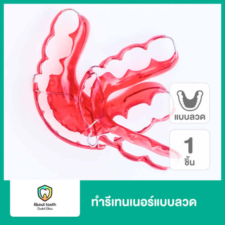 ทำรีเทนเนอร์ แบบลวด 1 ชิ้น (บนหรือล่าง) ที่ About Tooth Dental Clinic