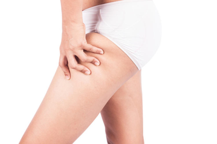 กระชับต้นขา ด้วย RF Slimming 1 ครั้ง ที่ KIHS Clinic