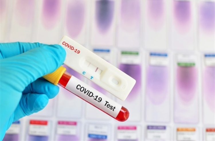 บริการตรวจหาภูมิคุ้มกัน COVID-19 ด้วยชุดทดสอบแบบรวดเร็ว (Rapid Test) ที่ Medical Line Lab