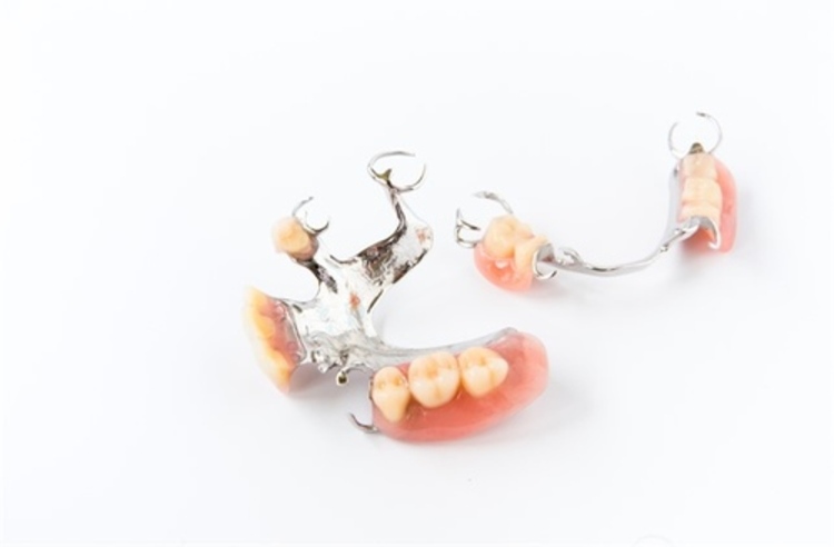 ทำโครงฟันปลอม แบบอะคริลิก ชนิดถอดได้ ที่ BFC Dental (บ้านฟันสวย)