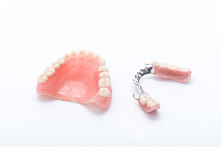 ทำโครงฟันปลอม แบบอะคริลิก ชนิดถอดได้ พร้อมฟันซี่แรก 1 ซี่ ที่ Ivory House Dental Clinic