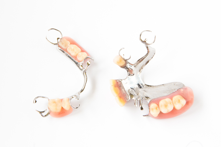 ทำโครงฟันปลอม แบบอะคริลิก ชนิดถอดได้ พร้อมฟันซี่แรก 1 ซี่ ที่ Double B Dental Clinic
