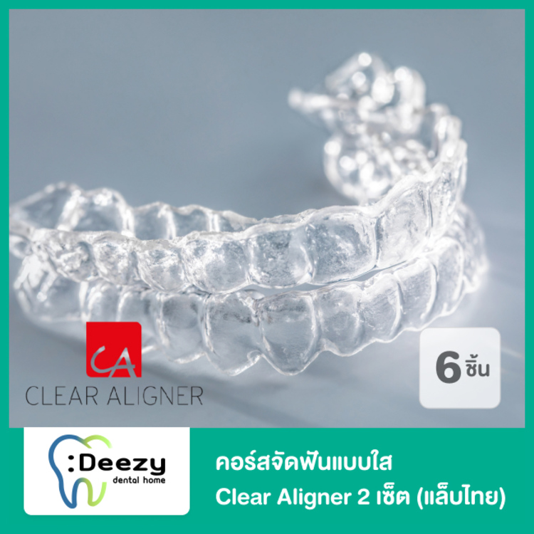 คอร์สจัดฟันแบบใส Clear Aligner 2 เซ็ต บนและล่าง (แล็บไทย) ที่ Deezy Dental Home