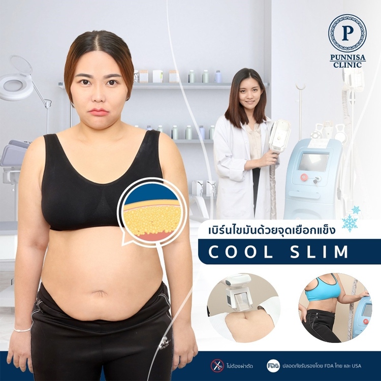 กำจัดไขมันส่วนเกินด้วยความเย็นจุดเยือกแข็ง (Cool slim) ด้วยเครื่อง Power Slim 1 บริเวณ 1 ครั้ง ที่ Punnisa Clinic (ปันนิสาคลินิก)